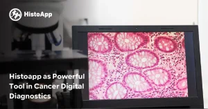 Histoapp as Powerful Tool in Cancer Digital Diagnostics